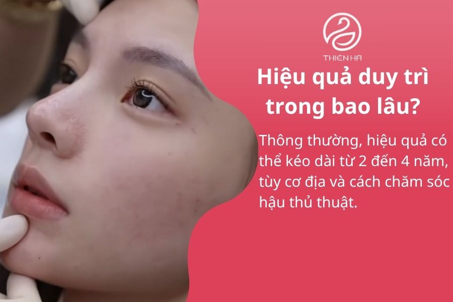 Một số câu hỏi thường gặp 
