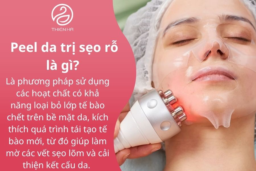 Peel da trị sẹo rỗ là gì?