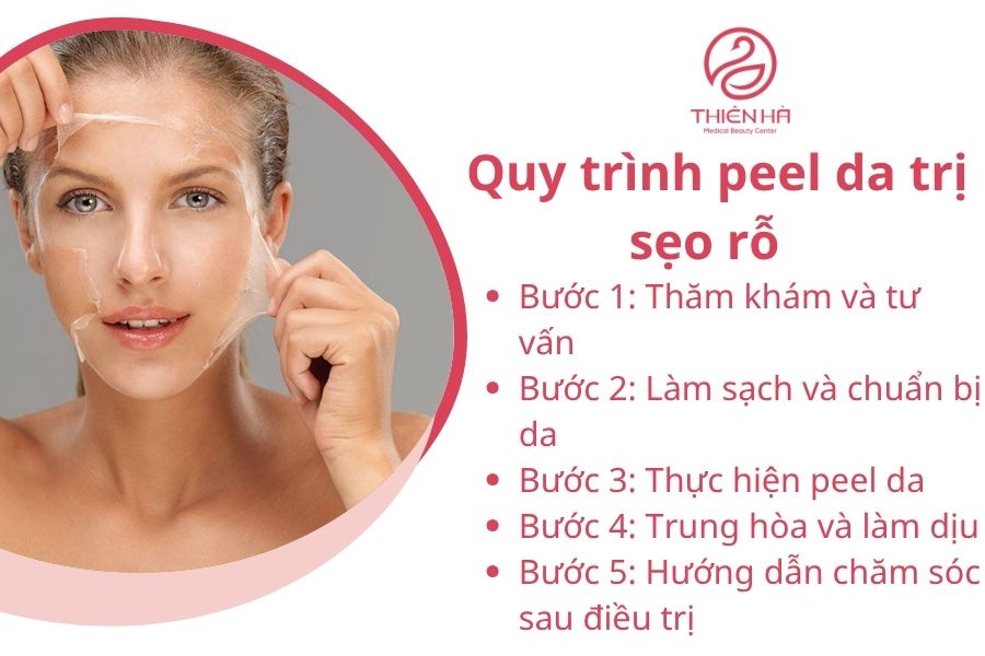 Quy trình peel da trị sẹo rỗ tại Viện thẩm mỹ Thiên Hà