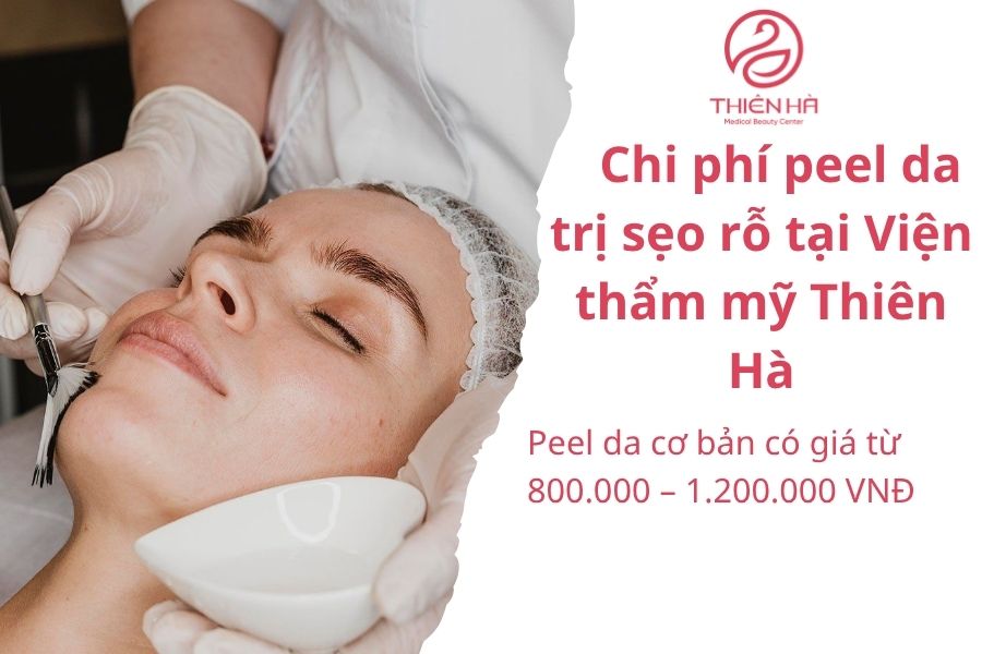 Chi phí peel da trị sẹo rỗ tại Viện thẩm mỹ Thiên Hà