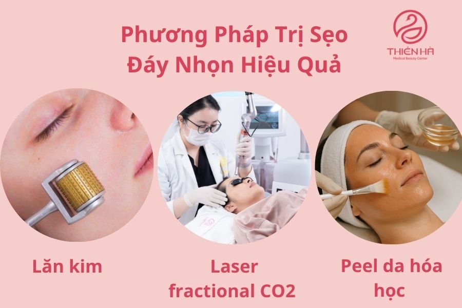 Các Phương Pháp Trị Sẹo Đáy Nhọn Hiệu Quả
