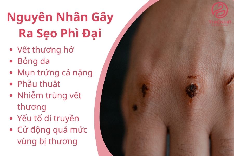 Nguyên Nhân Gây Ra Sẹo Phì Đại