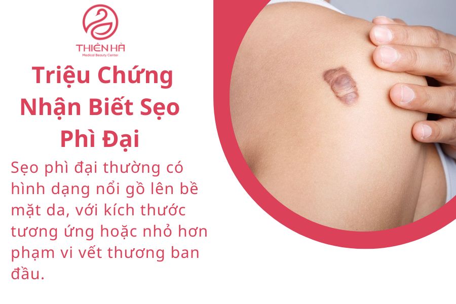 Triệu Chứng Nhận Biết Sẹo Phì Đại