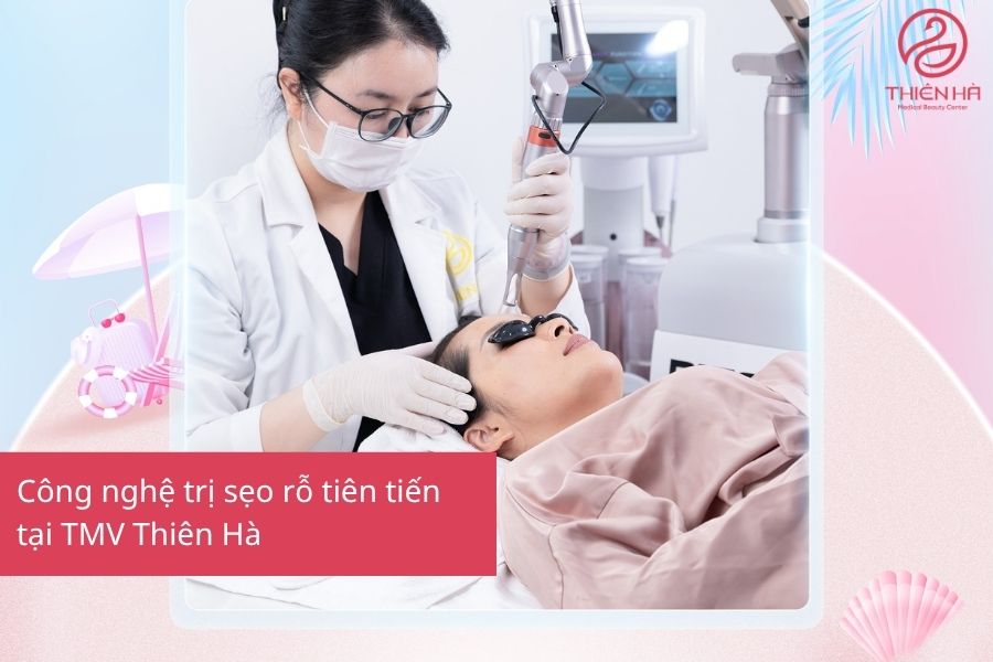Công nghệ trị sẹo rỗ tiên tiến tại TMV Thiên Hà