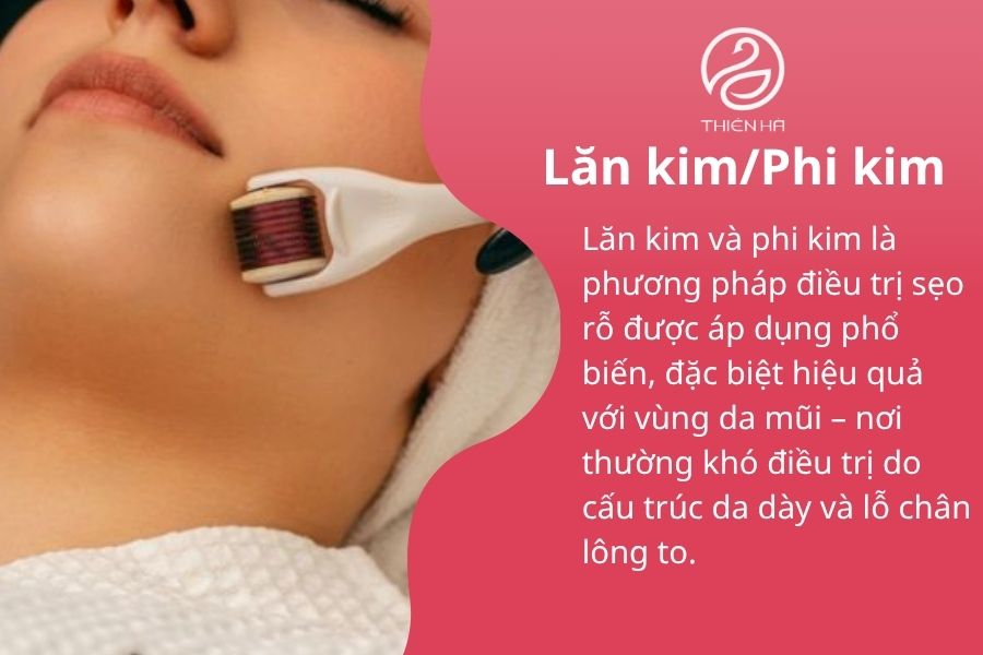 Lăn kim trị sẹo
