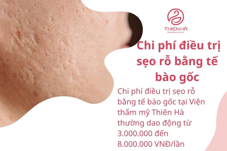 Chi Phí và Thời Gian Điều Trị