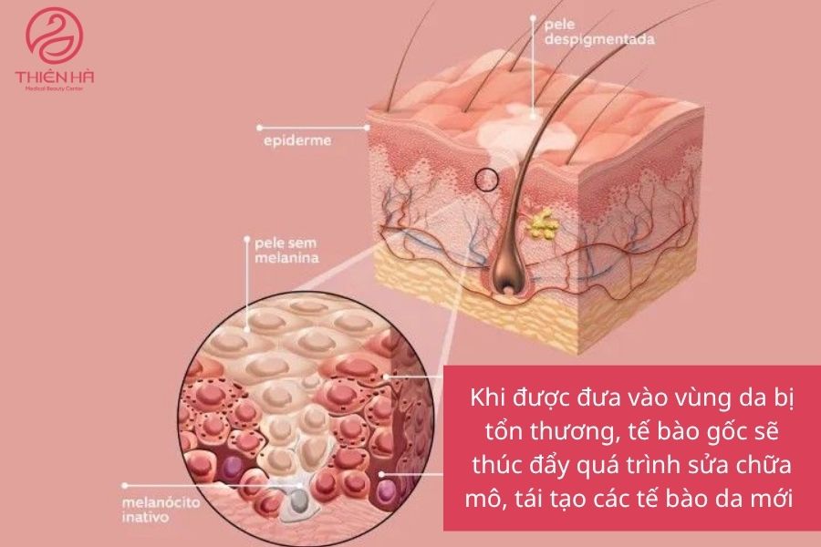 Cơ chế hoạt động của tế bào gốc trong việc tái tạo da