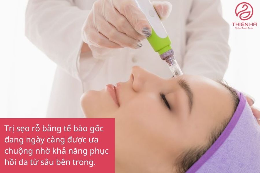 Ưu Điểm của Phương Pháp Trị Sẹo Rỗ Bằng Tế Bào Gốc