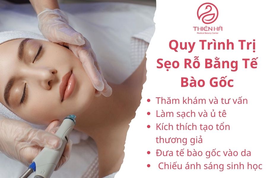 Quy Trình Trị Sẹo Rỗ Bằng Tế Bào Gốc