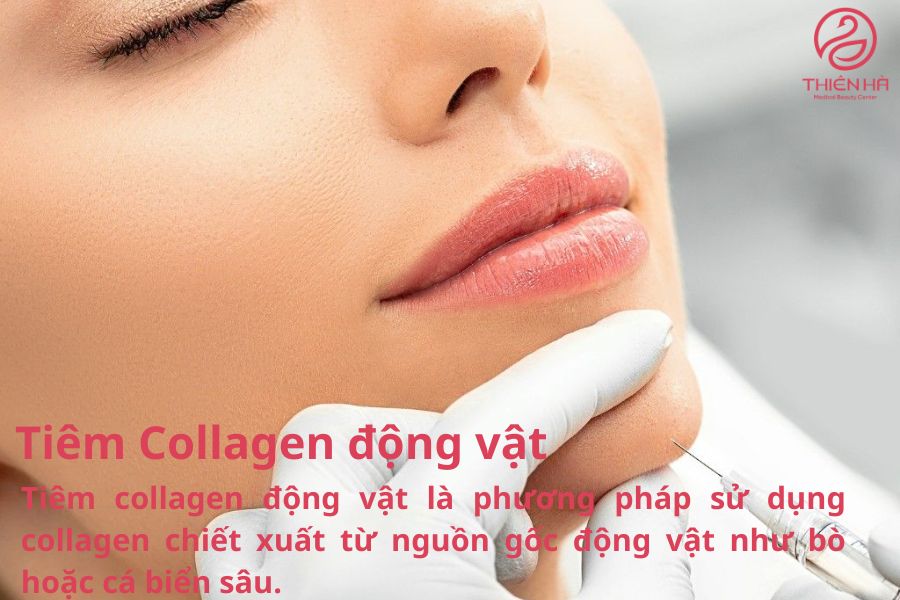 Tiêm Collagen động vật
