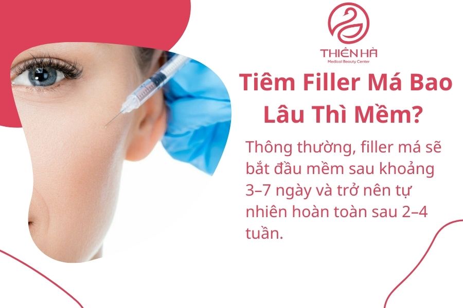 Tiêm Filler Má Bao Lâu Thì Mềm?
