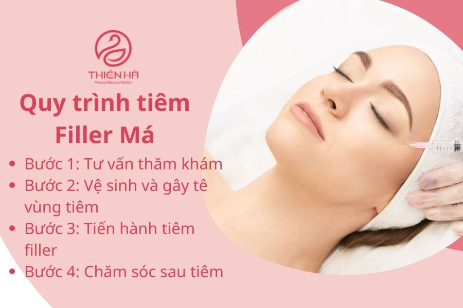 Quy trình tiêm filler má chuẩn y khoa 