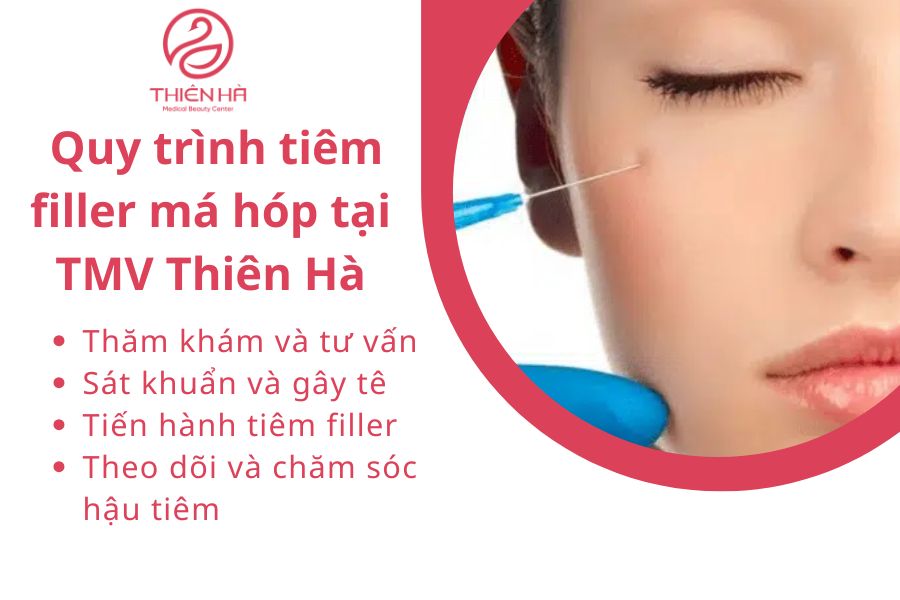 Quy trình tiêm filler má hóp tại Thẩm mỹ viện Thiên Hà
