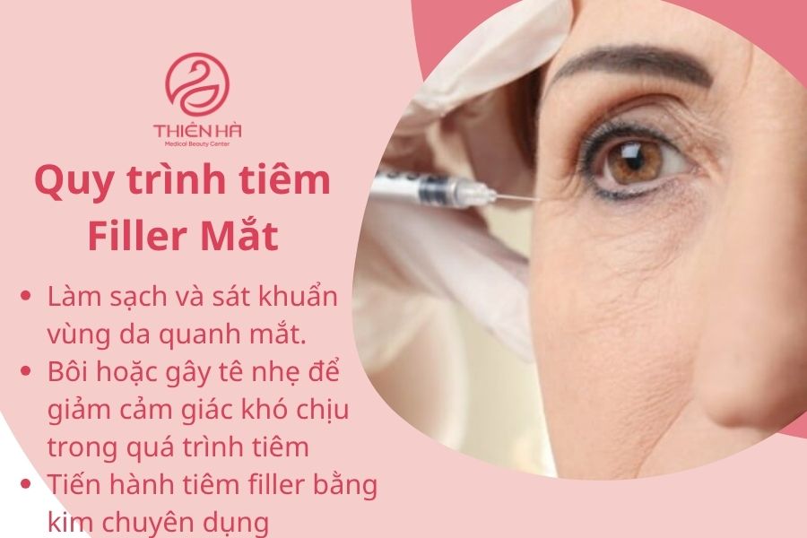 Quy trình tiêm filler mắt an toàn, chuẩn y khoa
