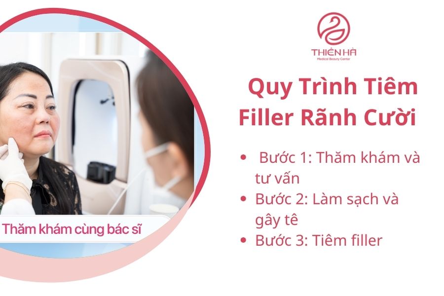 Quy trình tiêm filler rãnh cười chuẩn y khoa tại TMV Thiên Hà