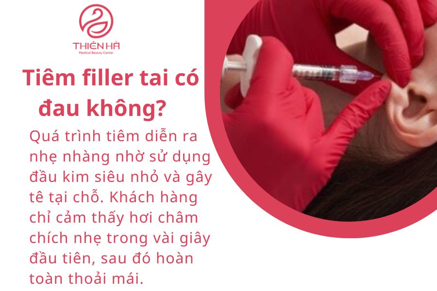 Một số câu hỏi thường gặp