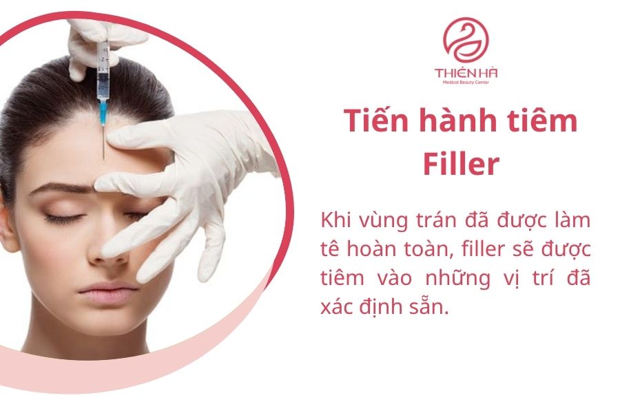 Quá trình tiêm filler trán được thực hiện bởi bác sĩ chuyên khoa