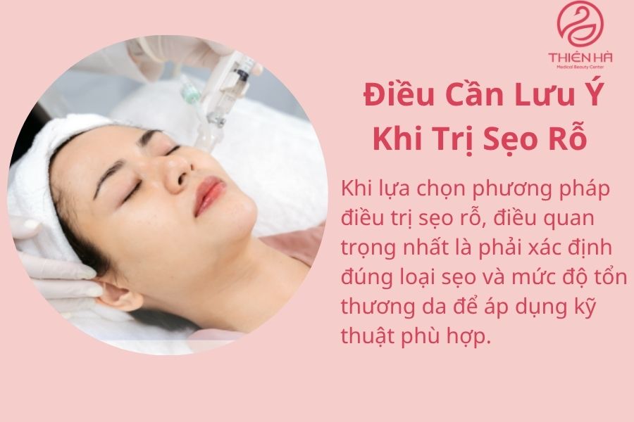 Những điều cần lưu ý 