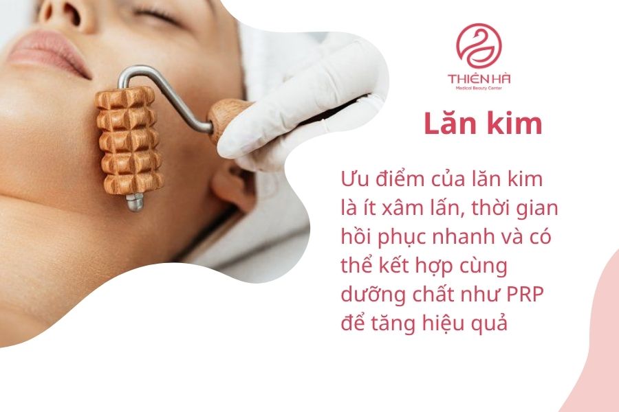 Lăn kim trị sẹo 