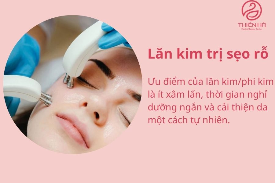 Lăn kim trị sẹo rỗ