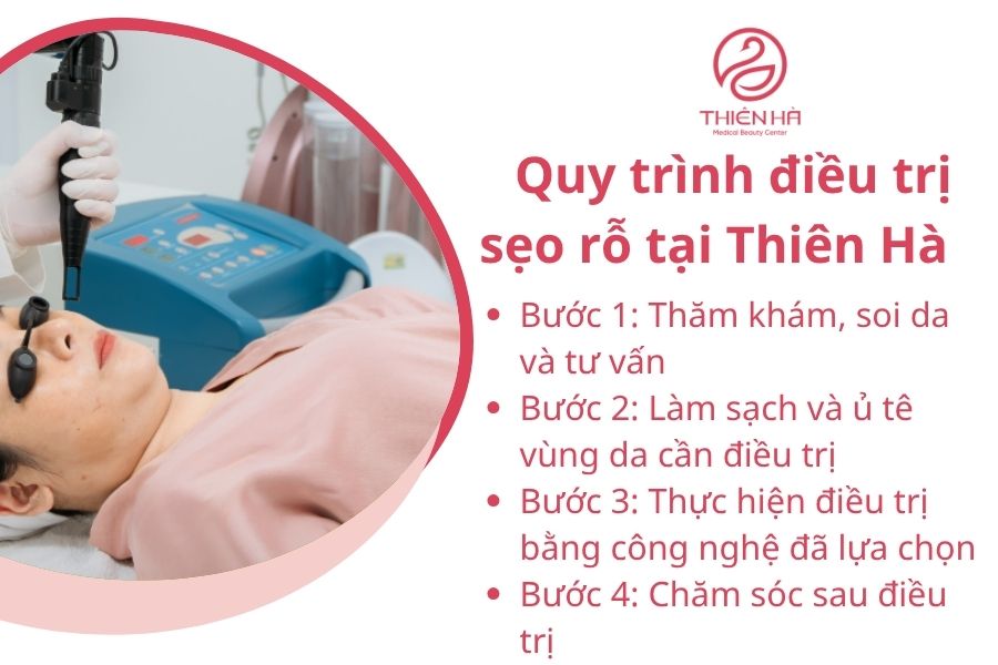 Quy trình trị sẹo rỗ tại Thiên Hà