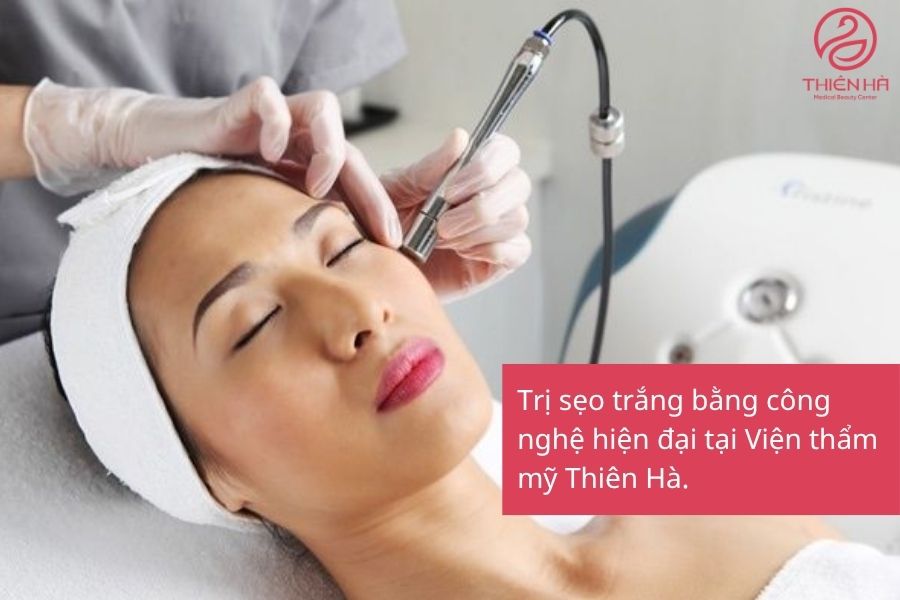 Trị sẹo trắng bằng công nghệ cao tại Viện thẩm mỹ Thiên Hà