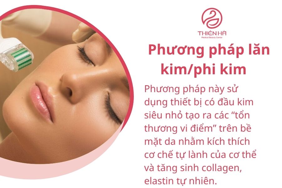 Phương pháp lăn kim/phi kim điều trị sẹo