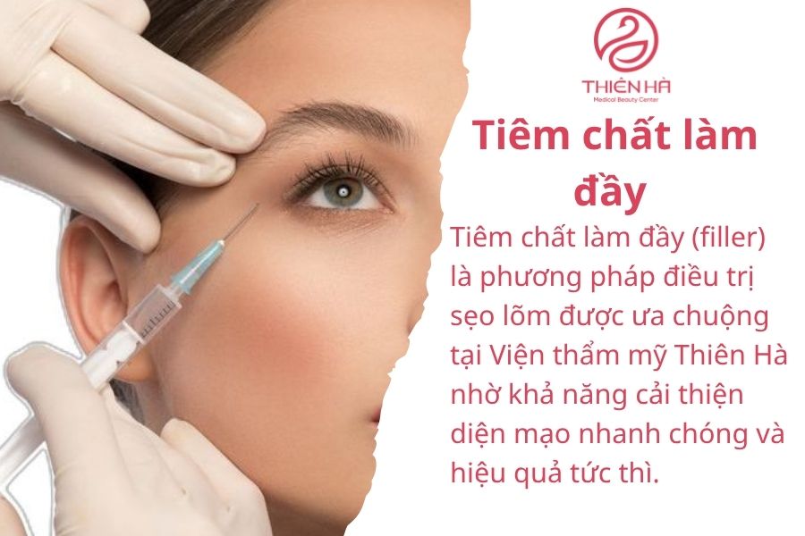 Tiêm chất làm đầy