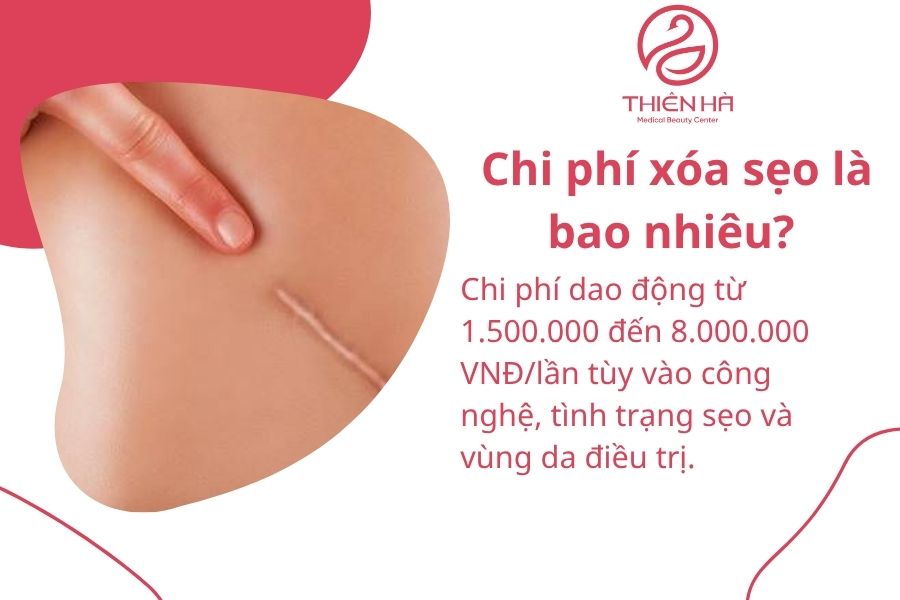 Một số câu hỏi thường gặp 