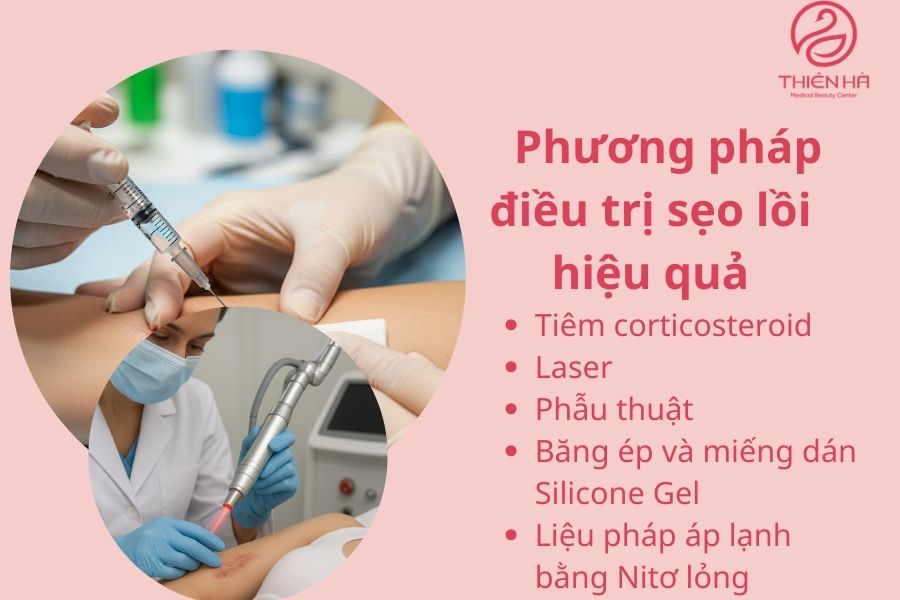 Top 5 bệnh viện thẩm mỹ trị sẹo lồi uy tín hiệu quả cao 2 Các phương pháp điều trị sẹo lồi hiệu quả tại bệnh viện thẩm mỹ