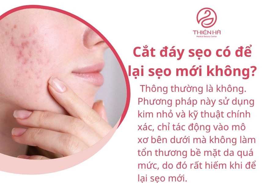 Cắt đáy sẹo: Phương pháp hiệu quả loại bỏ sẹo lõm, sẹo rỗ 6 Một số câu hỏi thường gặp
