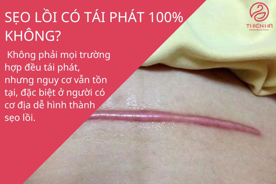 Giải đáp câu hỏi thường gặp về cắt sẹo lồi 