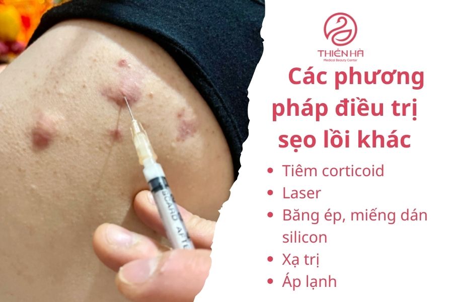 Tiêm corticoid trị sẹo lồi 