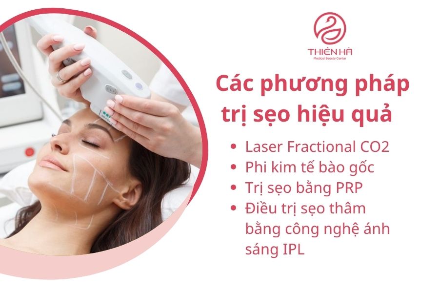 Chữa Sẹo Bằng Hành Tím: Hiệu Quả Thật Hay Chỉ Là Lời Đồn? 4 Phương pháp trị sẹo hiệu quả
