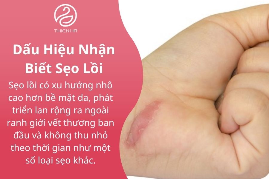 Dấu hiệu nhận biết sẹo lồi 