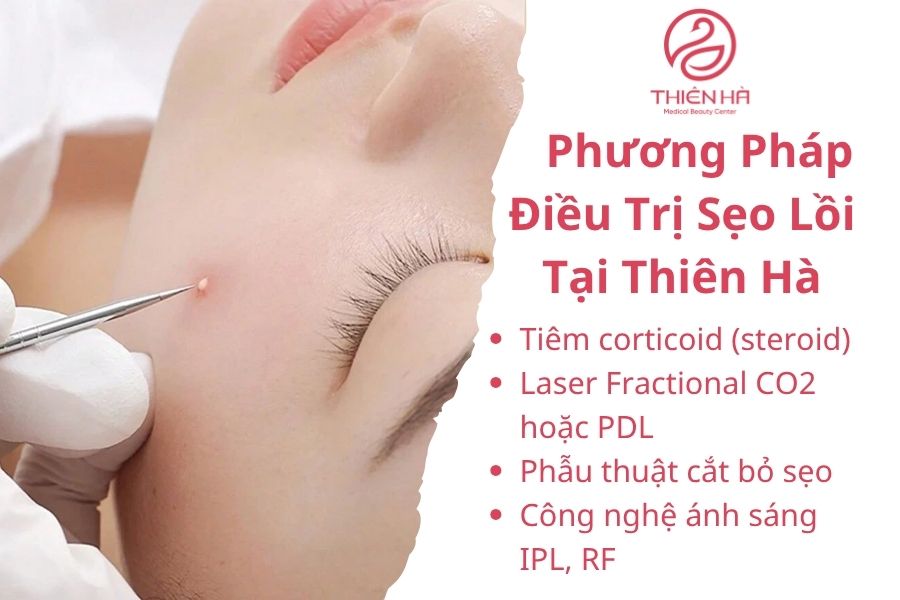 Phương Pháp Điều Trị Sẹo Lồi Tại Viện Thẩm Mỹ Thiên Hà