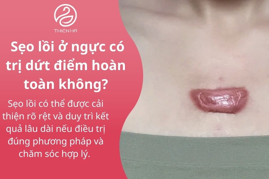 Một số câu hỏi thường gặp 