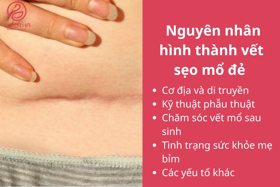  Nguyên nhân hình thành vết sẹo mổ đẻ 