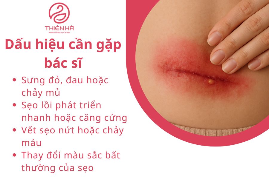 Dấu hiệu cần gặp bác sĩ 