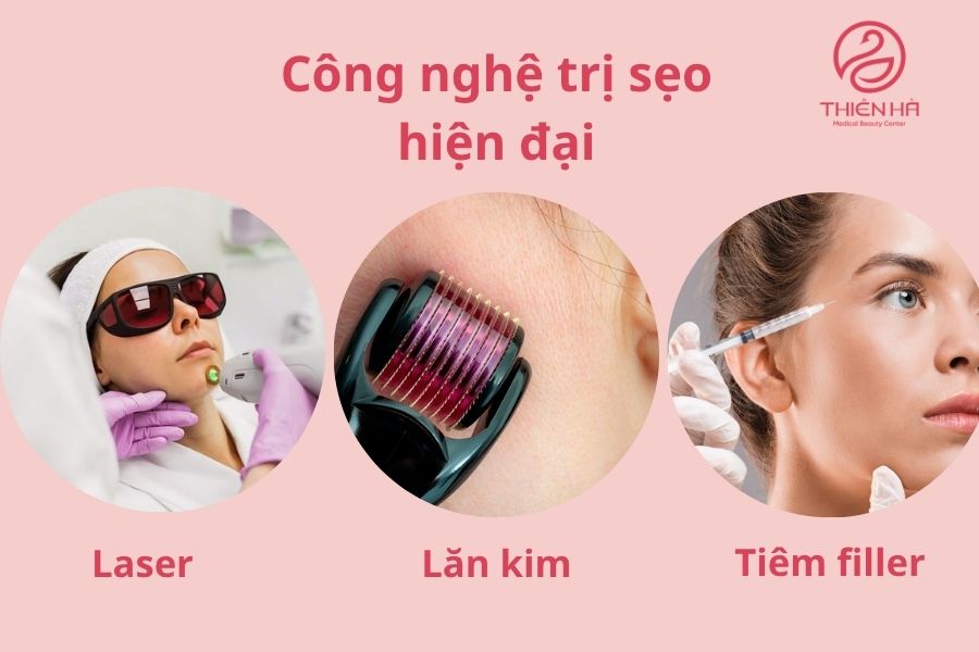 Các công nghệ trị sẹo lâu năm tại thẩm mỹ viện