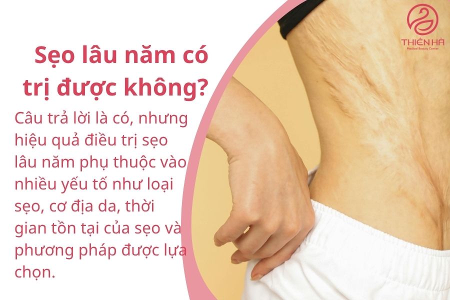 Sẹo lâu năm có trị được không?