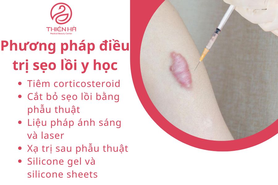 Phương pháp điều trị sẹo lồi y học : Tiêm corticosteroid