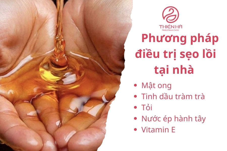 Phương pháp điều trị sẹo lồi tại nhà : Mật ong