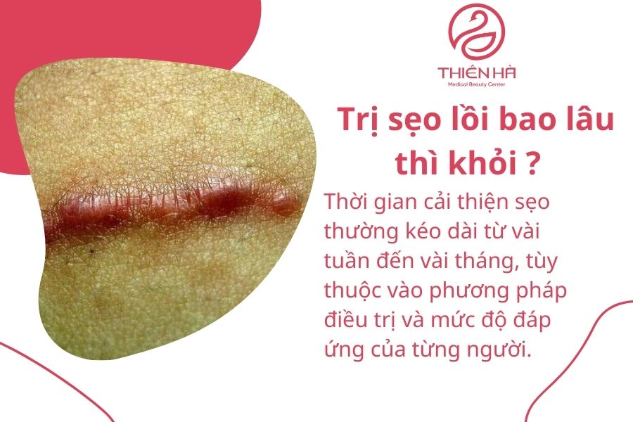 Câu hỏi thường gặp về trị sẹo lồi 
