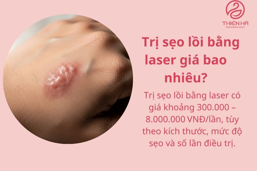 Trị Sẹo Lồi Bằng Laser Giá Bao Nhiêu? Thẩm Mỹ Viện Thiên Hà 3 Trị sẹo lồi bằng laser giá bao nhiêu?