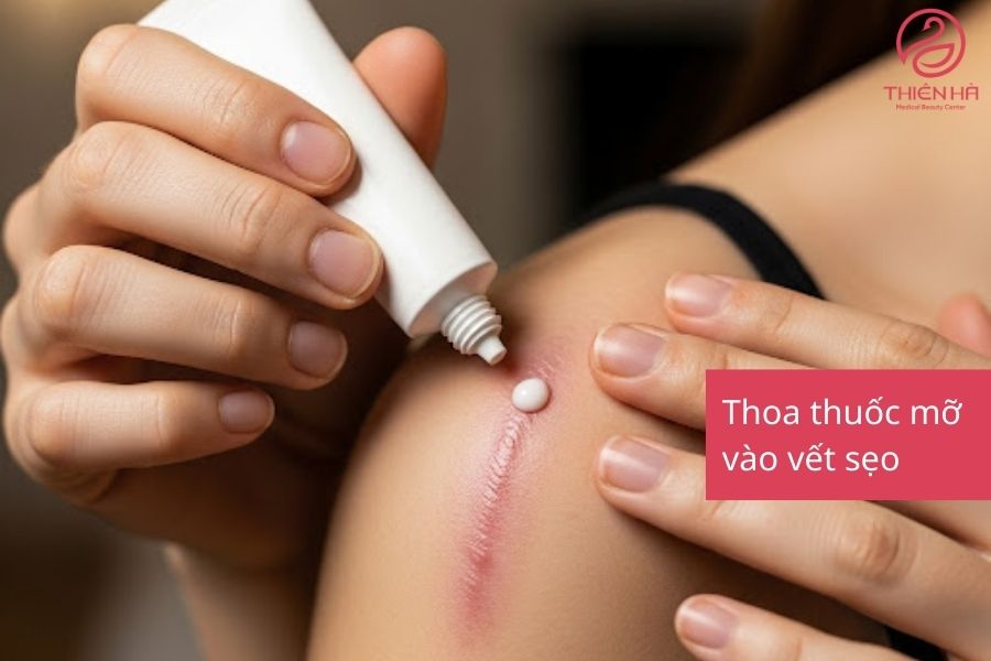 Trị Sẹo Lồi Bằng Laser Giá Bao Nhiêu? Thẩm Mỹ Viện Thiên Hà 6 Thoa thuốc mỡ vào vết sẹo