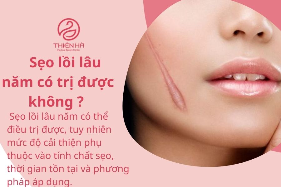 Giái đáp thắc mắc sẹo lồi lâu năm có trị được không ? 