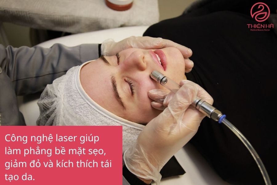 Laser (xung màu, fractional CO₂) trị sẹo lồi lâu năm