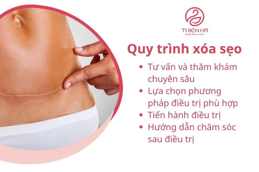 Xóa sẹo lâu năm giá bao nhiêu? Bảng giá chi tiết tại TMV Thiên Hà 4 Quy trình xóa sẹo tại Thẩm mỹ viện Thiên Hà