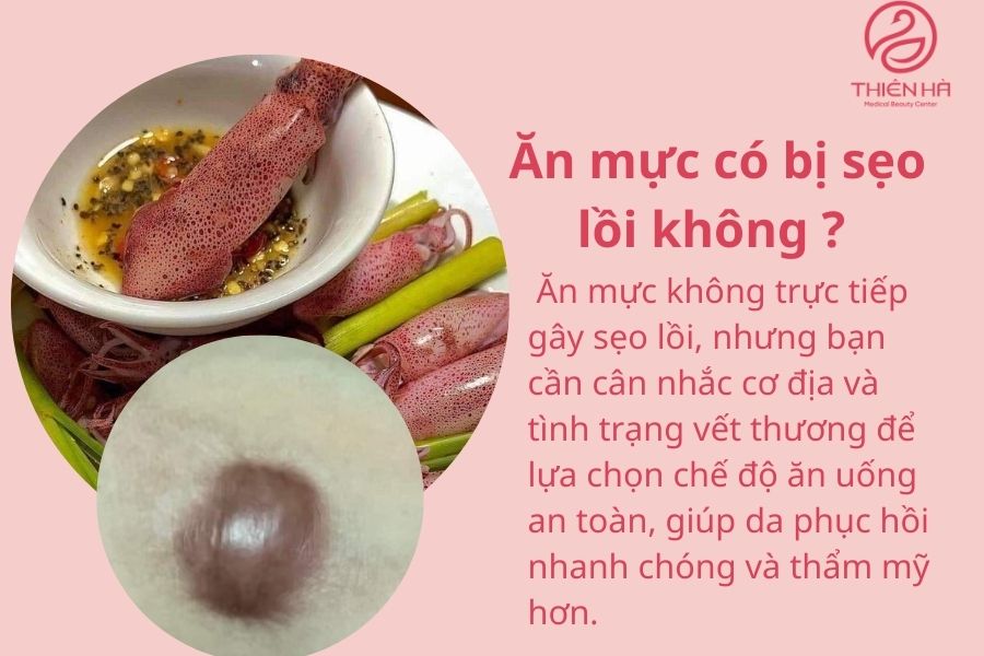 Ăn mực có bị sẹo lồi không